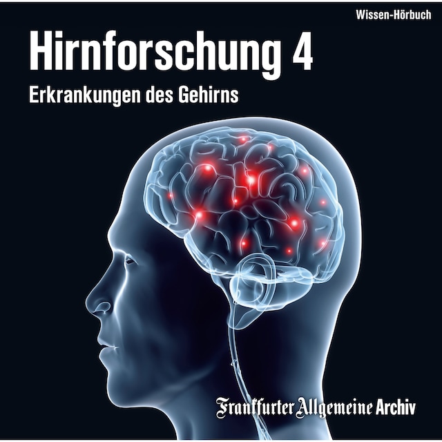Book cover for Hirnforschung 4