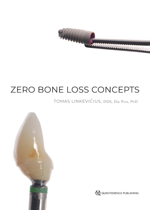 Copertina del libro per Zero Bone Loss Concepts