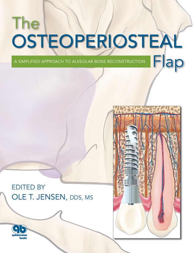 Book cover for The Osteoperiosteal Flap