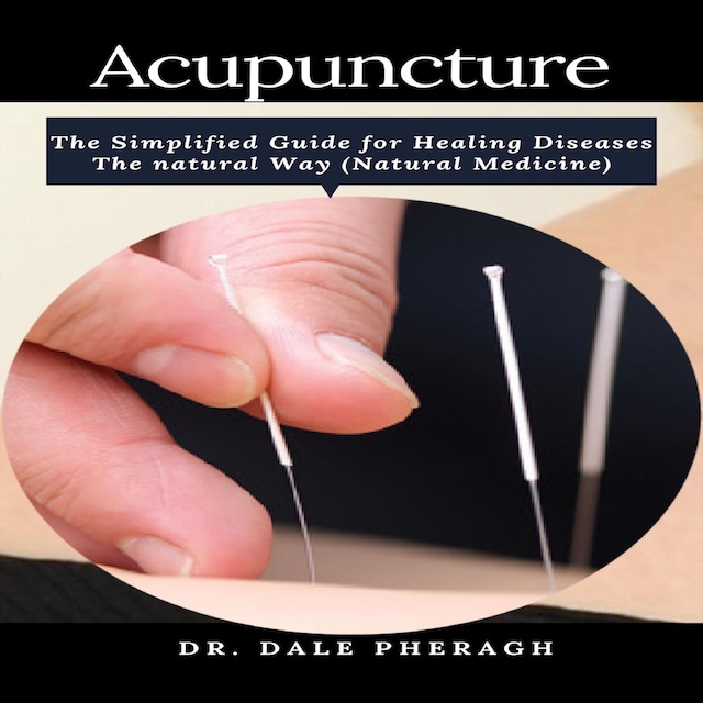 Book cover for Acupuncture: The Simplified Guide for Healing Diseases The natural Way (Natural Medicine)