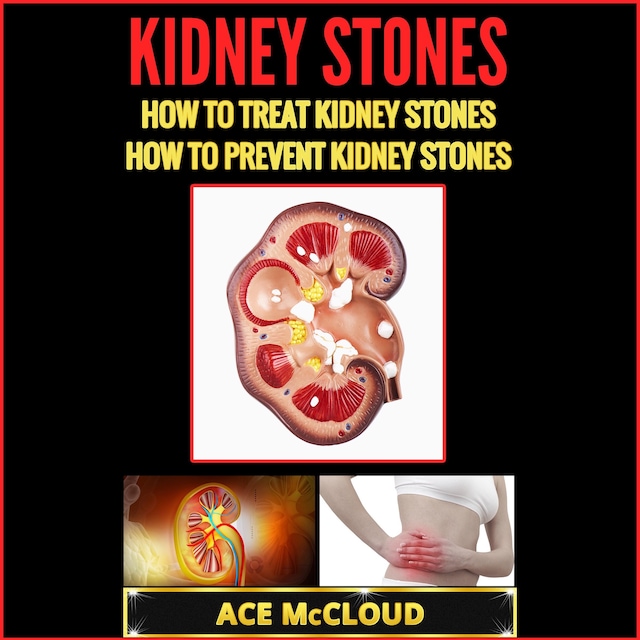 Book cover for Kidney Stones: How To Treat Kidney Stones: How To Prevent Kidney Stones