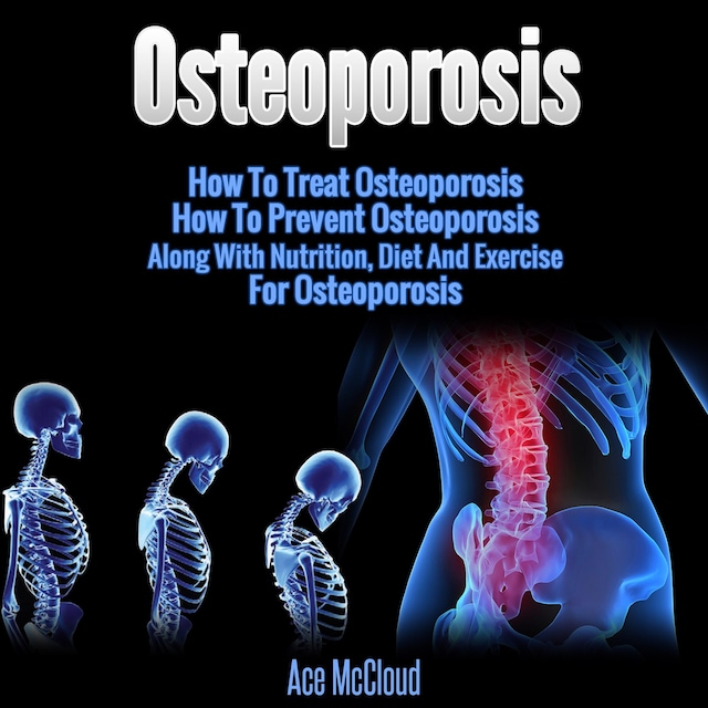 Book cover for Osteoporosis: How To Treat Osteoporosis: How To Prevent Osteoporosis: Along With Nutrition, Diet And Exercise For Osteoporosis