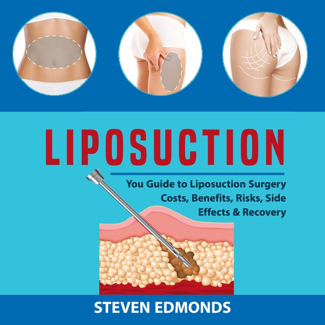 Book cover for Liposuction: You Guide to Liposuction Surgery Costs, Benefits, Risks, Side Effects & Recovery