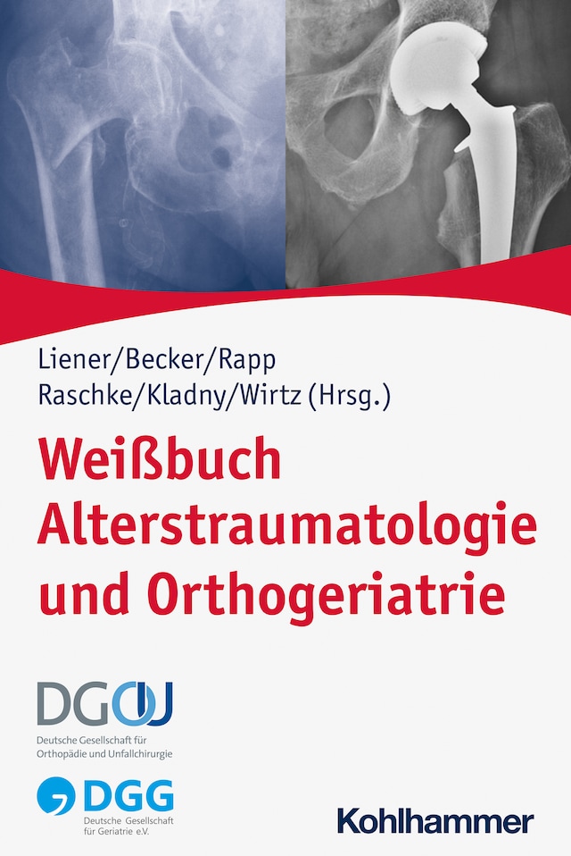 Bogomslag for Weißbuch Alterstraumatologie und Orthogeriatrie