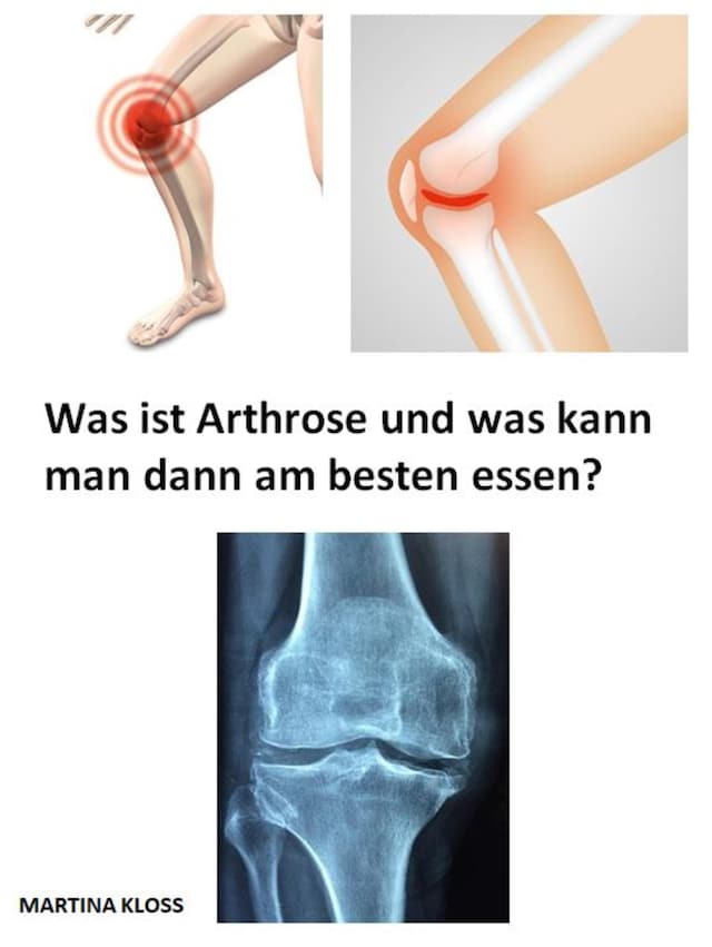 Buchcover für Was ist Arthrose und was kann man dann am besten essen?