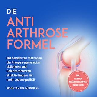 Die Anti Arthrose Formel: Mit bewährten Methoden die Knorpelregeneration aktivieren und Gelenkschmerzen effektiv lindern für mehr Lebensqualität - inkl. Rezepten, Ernährungskompass, Übungen uvm. als Hörbuch