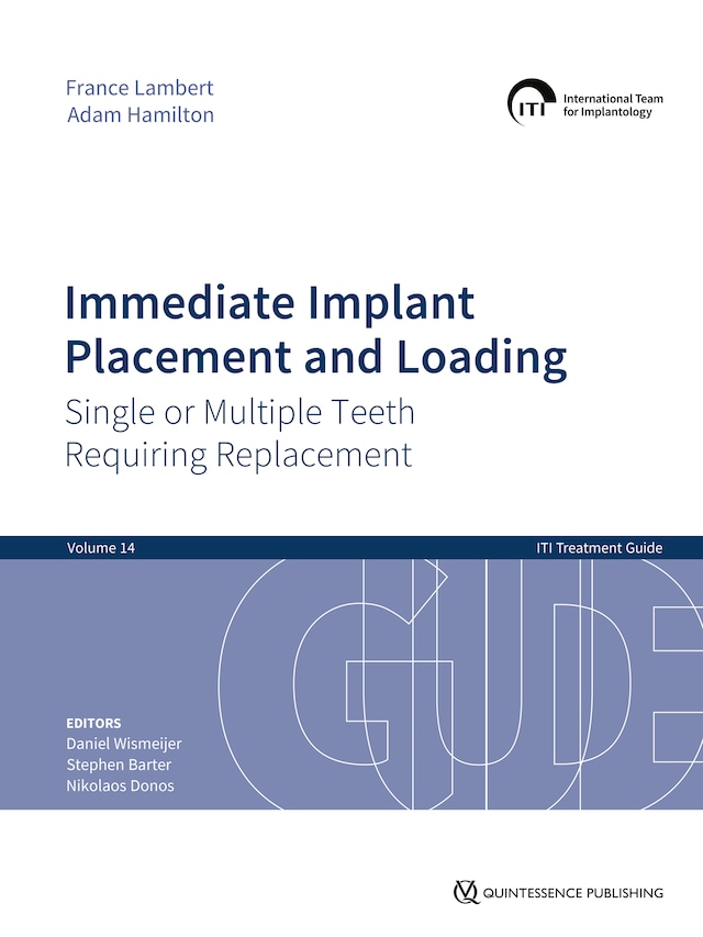 Book cover for Immediate Implant Placement and Loading – Single or Multiple Teeth Requiring Replacement