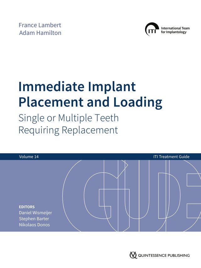 Kirjankansi teokselle Immediate Implant Placement and Loading – Single or Multiple Teeth Requiring Replacement