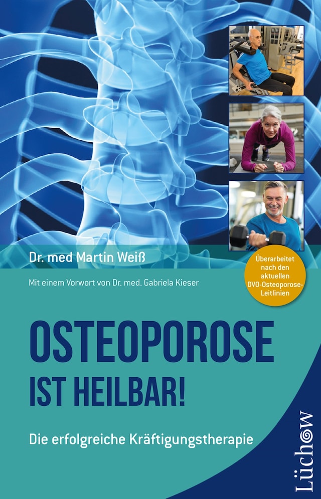 Book cover for Osteoporose ist heilbar!