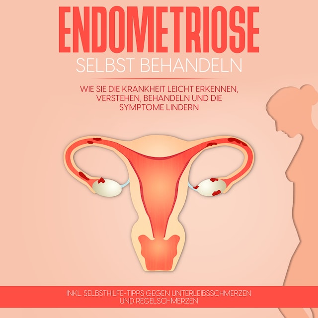 Boekomslag van Endometriose selbst behandeln: Wie Sie die Krankheit leicht erkennen, verstehen, behandeln und die Symptome lindern - inkl. Selbsthilfe-Tipps gegen Unterleibsschmerzen und Regelschmerzen