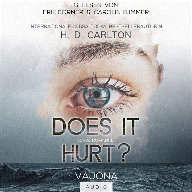 Book cover for DOES IT HURT?