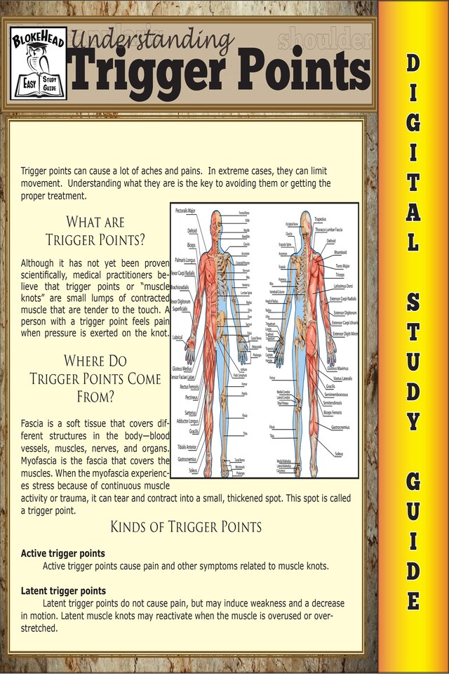 Buchcover für Trigger Points (Blokehead Easy Study Guide)