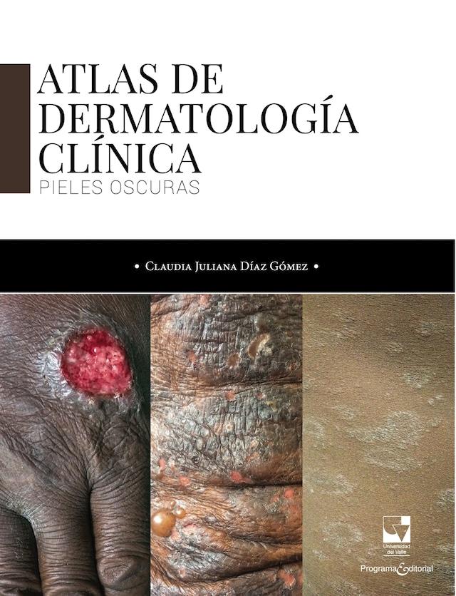Book cover for Atlas de dermatología clínica