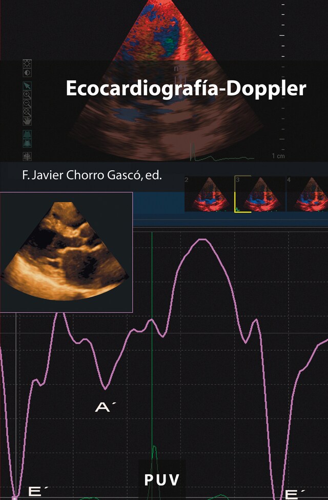 Book cover for Ecocardiografía-Doppler