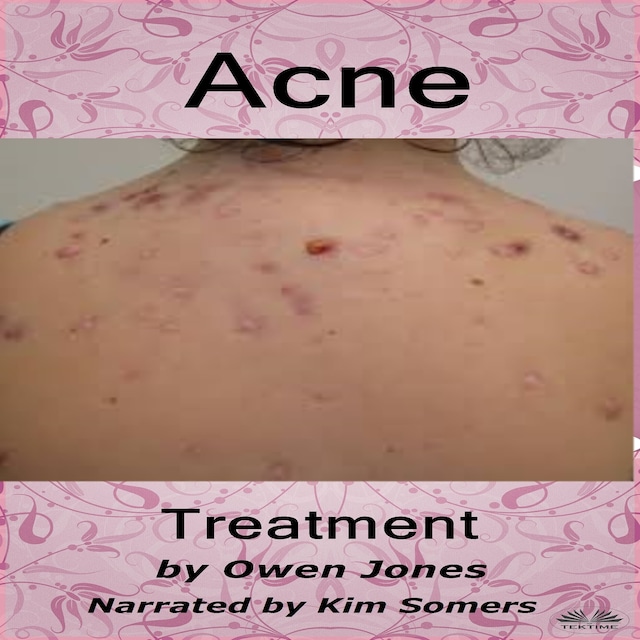 Copertina del libro per Acne Treatment