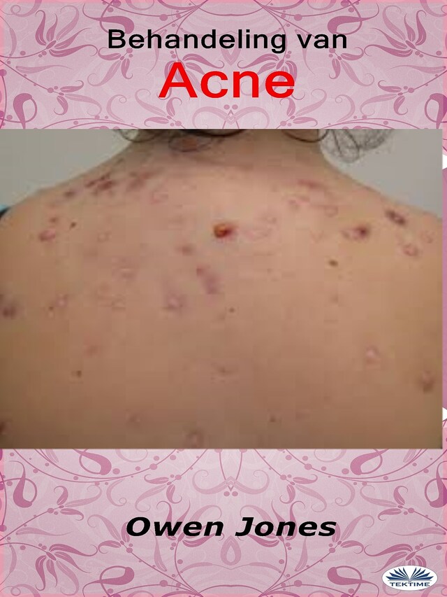 Portada de libro para Behandeling Van Acne