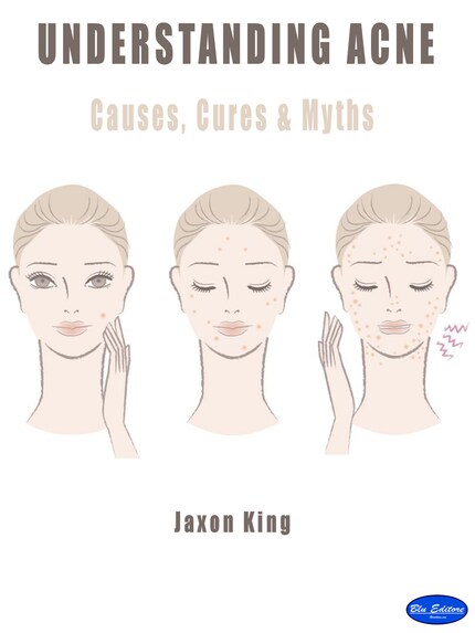 Understanding Acne bookCoverFor