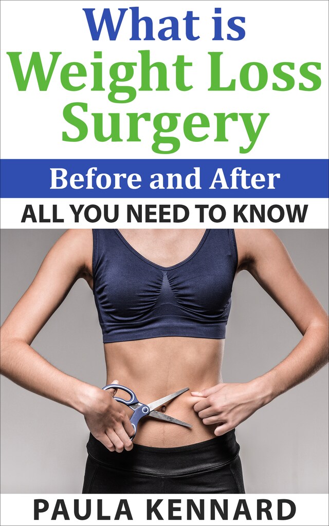 Book cover for What Is Weight Loss Surgery: All You Need To Know Before And After