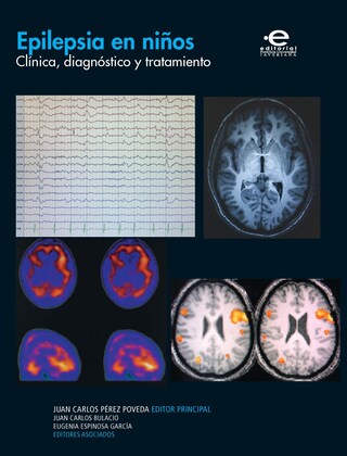 Epilepsia en niños bookCoverFor