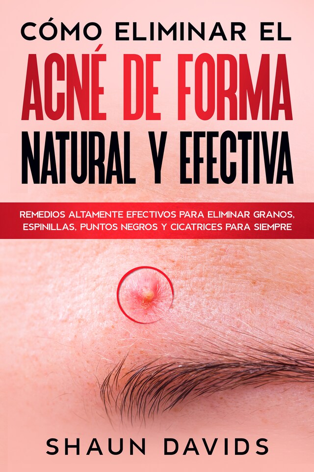 Buchcover für Cómo Eliminar el Acné de Forma Natural y Efectiva