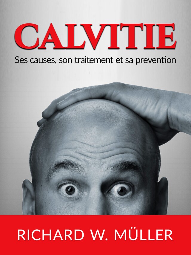 Calvitie (Traduit)