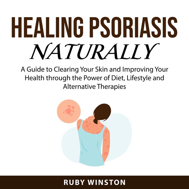 Couverture de livre pour Healing Psoriasis Naturally