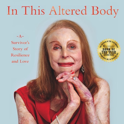 In This Altered Body