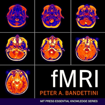 fMRI